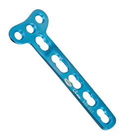 Locking Plates
